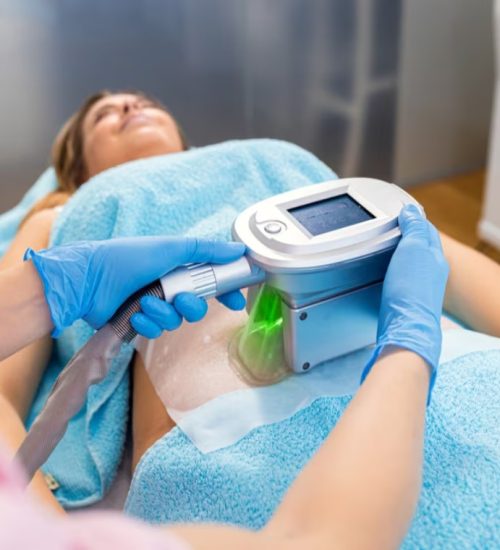 criolipolisi_900x760